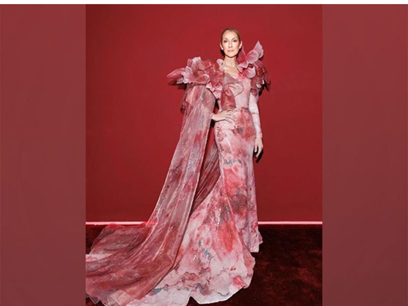 सेलीन डायोन ने स्टिफ़-पर्सन सिंड्रोम निदान के बाद पहले संगीत कार्यक्रम की घोषणा की